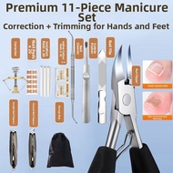 IMLUCKY | Ingrown Toenail Corrector