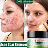 Acne treatment ointment Treatment of adolescent acne Facial scar acne removal Inhibit acne 30g