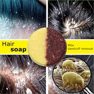 【cw】 Dandruff Shampoo Itching Anti Flakes Scalp Treatment Moisturizing Hair keratin