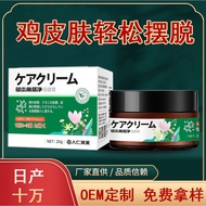 Exfoliating Chicken Skin Fish Scale Snake Skin Cream Moisturizing Body Care Exfoliating Chicken Skin