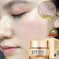 Krim jeragat Whitening Freckle Remover cream 377 Dark spot remover remove Melasma 377美白淡斑面霜
