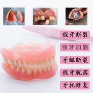 活動假牙膠水假牙脫落粘固牙齒斷裂義齒假牙固定修復假牙粘接劑YL0505