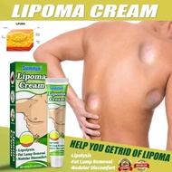 【FAST EFFECT】20g Lipoma Removal Cream Treat Tumor Skin Swelling Ointment Herbal  Original cyst remov