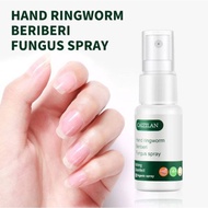 CAIZILAN Hand nail Ringworm beriberi fungus spray Terapi rawatan kuku anti kulat Menghapuskan kulat 