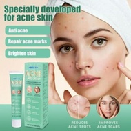 20g HBESTY ACNE Care Cream 痤疮祛痘膏