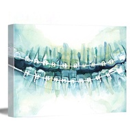 Canvas Wall Art Braces Watercolor Print  Braces Art  Teeth Art  Dental Art Farmhouse Kitchen Decor Modern Canvas Wall Art