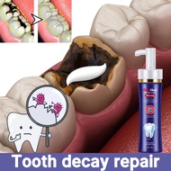 Anti-caries toothpaste/Probiotic Toothpaste/Teeth whitening toothpaste 150g Children's Anti - Cavity