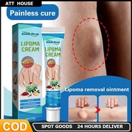 lipoma cream benjolan ubat benjolan lipoma removal cream Removal Multiple Single Lipoma Subcutaneous