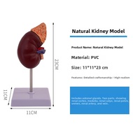 Blue butterfly | Anatomical Kidney Model with Adrenal Gland and Pathology Illustration