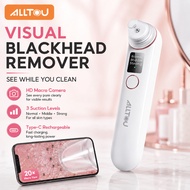 ALLTOU Visual Blackhead Remover Vacuum with HD Camera App | 3 Suction Levels Type-C Pore Cleaner