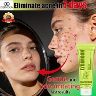 Salicylic Acid Acne Gel Cleanser， | Salicylic, Lactic & Lactobionic Acid | For Oily & Acne-Prone Ski