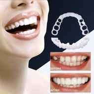 NEW VENNER WHITE PERAPIH GIGI / SNAP ON SMILE VENEERS GIGI PERFECT