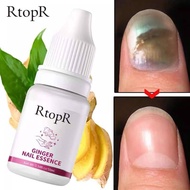 RTOPR GINGER NAIL ESSENCE Pati kuku halia rawatan kuku nail treatment cantikkan kuku hitam kuning pe