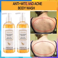 sabun gatal kulit eczema eczema body wash eczema treatment Gatal Kulit treatment eczema psoriasis Ri