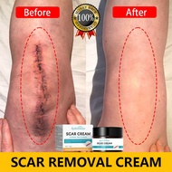 Scar Removal Cream Repair Old Scar Fades Scars Moisturizing Scar Treatment External Health Care Crea