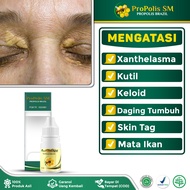 Obat Herbal Penghilang Xanthelasma Mata Ori Santelasma - Propolis SM Brazil Original BPOM RESMI