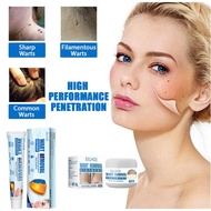 EELHOE 50g Painless Warts Remover Cream Mole & Skin Tag Remover ketuat karat remove Corn Plaster Ant