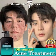 【Local shop】Pencuci muka lelaki acne men wash face blackhead remover alat sedut blackhead tidact acne