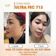 ULTRA FEC 713 ULANNI SKIN REGENERATIVE
