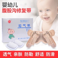 Hernia bayi, hernia inguinal pediatrik, hernia kantung pada bayi lelaki dan perempuan, hernia usus k