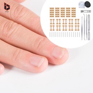 [Blesiya] Ingrown Toenail Correction Patch, Breathable Toenail Correction Stickers, Pedicure Tools