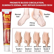 LEG EDEMA CREAM anti-bloating edema massage CREAM Improves blood circulation, foot massage, calf, an