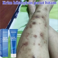 Krim hilangkan parut hitam Hilangkan parut kaki Hilangkan parut kudis parut luka lama mosquito bite 