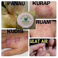 New Ubat Gatal Aloe Vera
