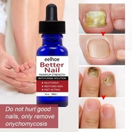 เซรั่มซ่อมแซมเล็บ nail fungus medicine ยาแก้เชื้อราที่เล็บ ยากันเชื่อราเล็บ บำรุงเล็บเสีย（น้ำมันบำรุ