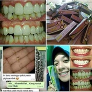 obat gigi nasa anti karang,sakit gigi, sakit gusi, sariawan