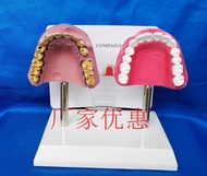 รูปแบบการพยาบาลฟันฟันทางพยาธิวิทยาทางการแพทย์รูปแบบการดูแลช่องปากการสูบและอุปกรณ์ฟันช่องปากปกติ