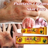 Krim Gatal Ekzema Pure Chinese Herbs Eczema Psoriasis Anti Fungal Treatment Cream 藏药皮宝抑菌乳膏