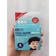 ACUMEDI ORAL ULCER PATCH PATCHES 6S