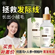 侗染防脱固发育发液强韧发根生发密发人参侧柏叶植物养发减少掉发Dong Dye Anti-stripping and Hair-fixing Liquid Strong and Tough Hair R