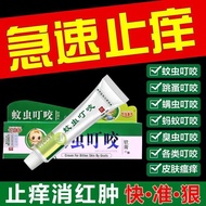 Anti-itch cream for mosquito bites Flea mites ant bites skin allergy itching anti-swelling anti-fungal anti-itch cream