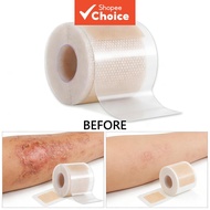 Invisible Scar Silicone Gel Sheet - Self-Adhesive Scar Removal Patch for Surgery, C-Section & Acne S