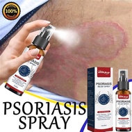 【Loca Ship】 Psoriasis Eczema Itchy Skin 30ml Chinese Herbal Itchy Skin Cream Anti-Fungal Itch Medici