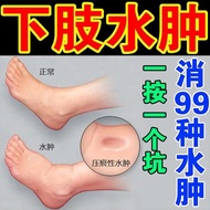 Edema-Reducing Handy Tool Medicine Lower Limb Diaper Drainage Diaper Face Elderly Edema-Reducing Foo