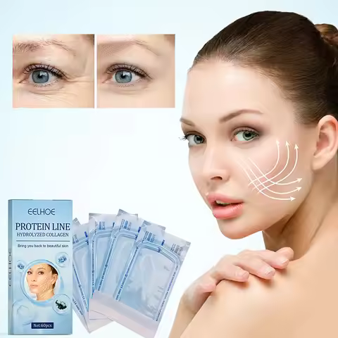 Radar Thread No Needle Silk Fibroin Line Carved Protein Line Collagen for Facial Lift Anti Aging Hya