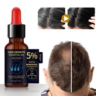 5% Biotin Minoxidil Hair Growth Oil, Hair Growth Serum Minoxidil 20ml