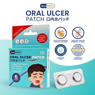 Oral Ulcer Patch Viral TikTok