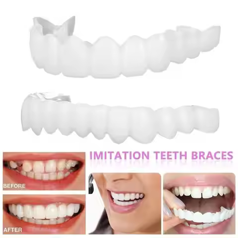 Snap on Smile Dental Upper Lower Fake Teeth Cover Bright Veneers Comfort Fit Flex Dentures Braces Sn