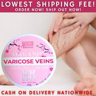 VARICOSE VEINS HEALING CREAM  VARICOSE CREAM  VARICOSE VEINS REMOVER  VARICOSE CREAM ORIGINAL  VARIC