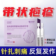 With Herpes Post-genetic Neuropathy Special Use Medicine Supervision Case Breaking External Use Crea