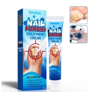 Krim merawat kuku bermasalah / kuku cagu / kuku sebayan / kulat kuku / bakteria kuku NAIL FUNGUS TRE