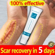 100% effective Scar removal cream ​Scar remover Acne Scar Removal Cream All scars can be used Repair damaged skin Repairing surgical scars and diminishing melanin scar and let skin re-grow and transform Dark Spot Remover Scar Removal Treatment