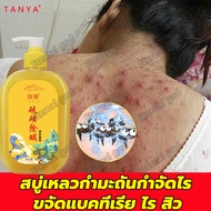 TANYA สบู่เหลวกำมะถันกำจัดไร ครีมอาบน้ำหอมๆ408ml ลบสิวควบคุมน้ำมัน ปรับสี ขจัดกลิ่นเหงื่อ ชะล้างรูขุ