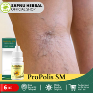 Obat Varises Obat Urat Menggumpal Di Kaki Obat Penghilang Benjolan Varises Obat Urat Menonjol Urat B