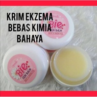 Krim Ekzema Berasaskan Shea Butter Pure Paling Berkesan : Lenyapkan Pedih Luka Ekzema,Lembabkan Ekze
