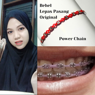 [Behel Mudah Lepas Pasang] Behel Praktis Lepas Pasang Sendiri Behel Power Chain behel lepas pasang s